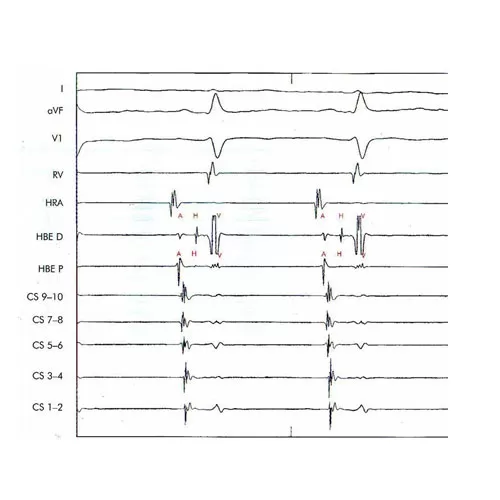 Electrophysiological examination